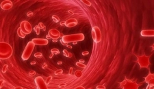 Lenfoma 1 Evre Lenfoma I Evresi Nasıl Gelişir?