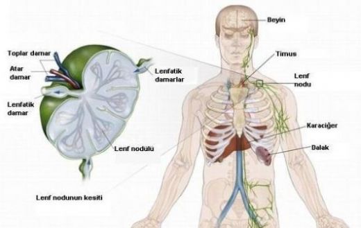 Hodgkin Lenfoma Kanseri